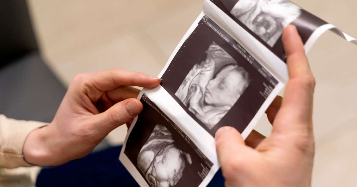 Kiedy wykonać pierwsze USG w ciąży?