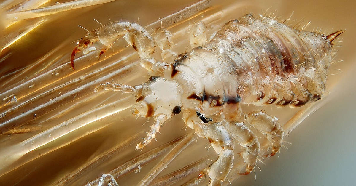 Jak wyglądają wszy u dzieci i jak się ich pozbyć?