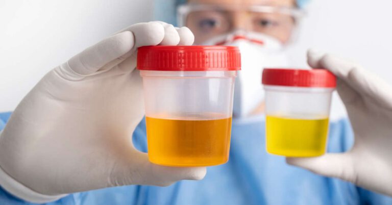Erytrocyty w moczu w ciąży – co oznaczają, norma, diagnoza